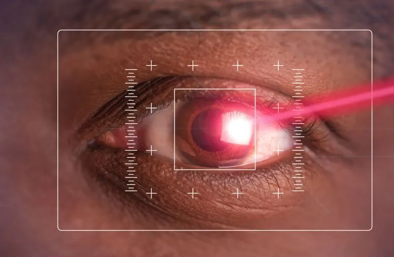 A macro image of an eye undergoing a personalized laser treatment, with a digital targeting grid overlay representing precision care.
